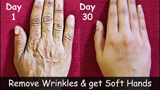 Remove Wrinkles from Hands | Make your Hands Look 10 Years Younger - Get Baby Soft Hands - Dry Hands