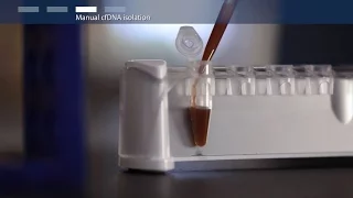 How to purify circulating cell-free DNA (cfDNA)