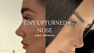 INSTANT RHINOPLASTY, tiny upturned nose in 1min (very powerful)