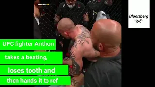 UFC fighter Anthony Smith takes a beating, loses tooth and then hands it to ref