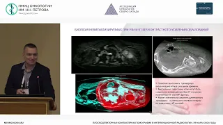 Новые возможности визуал, план-я и оценки результатов интервенц вмешат при исп ангиографич комплекса