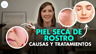 🔴 PIEL SECA o DESHIDRATADA ¡Causas y Tratamientos! @drapilarochoa - Dermatologa