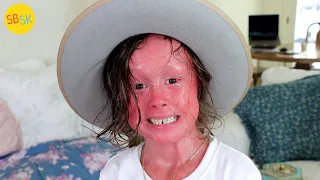 A Kid with Skin Growing Too Fast (Harlequin Ichthyosis)