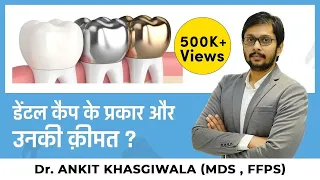 डेंटल कैप के प्रकार और उनकी क़ीमत ? Types of Dental caps Cost and type ?  Dr. Ankit Khasgiwala