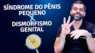Síndrome do Pênis Pequeno x Dismorfismo Genital | Dr. Marco Túlio Cavalcanti