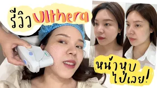 รีวิว Ulthera มาแล้วว หน้าหุบไปเลยค่าา บ้าจริง!║Evefee