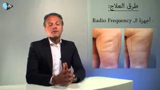 علاج للسلوليت بإستخدام تردد الراديو | Radio Frequency Cellulite Treatment | النهار | Dr Dany Touma