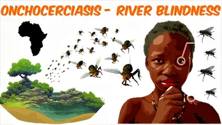 Onchocerciasis - River Blindness