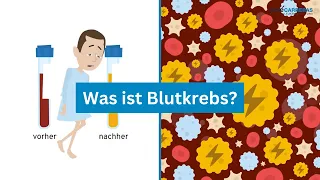 Was ist Leukämie/Blutkrebs? Symptome, Diagnose, Behandlungen