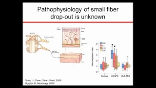 Small Fiber Neuropathy and ARA-290 Results