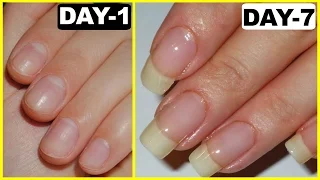 How to Grow Nails Faster - GUARANTEED RESULTS | Anaysa