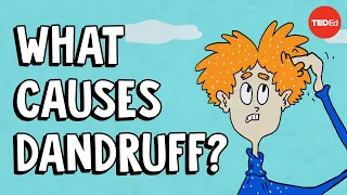 What causes dandruff, and how do you get rid of it? - Thomas L. Dawson