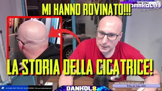 LA STORIA DELLA CICATRICE SULLA NUCA!!!