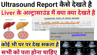 Ultrasound Report कैसे देखते है - Liver ultrasound report - रिपोर्ट मैं क्या क्या देखना होता है