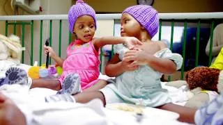 Conjoined Twins: Recovery