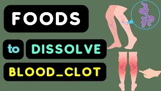 Blood Clots In Leg |  7 Amazing Foods That Dissolve Blood Clots In Legs Naturally