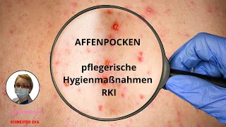 Affenpocken und pflegerische Hygienemaßnahmen