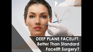 What is a Deep Plane Facelift?