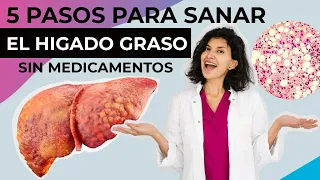 Como sanar el HÍGADO GRASO sin medicamentos: Pasos para eliminar el HÍGADO GRASO de forma natural