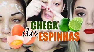 COMO ACABAR COM AS ESPINHAS EM 30 MINUTOS!