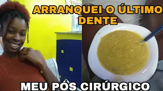 FUI NO DENTISTA - ARRANQUEI O ÚLTIMO DENTE QUE FALTAVA / COMO É O PÓS CIRÚRGICO #vlog