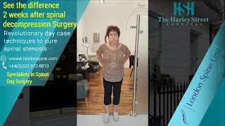 See the difference 2 weeks after spinal decompression Surgery (London Spine Unit )