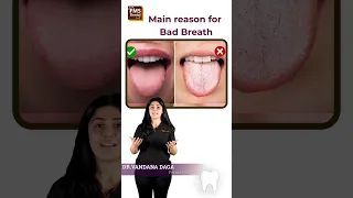 Reasons for bad breath | Bad Breath Treatment | Halitosis Treatment | FMS Dental