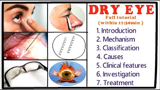 Dry Eye - Full Tutorial