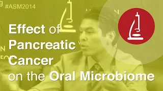 The Effect of Pancreatic Cancer on the Oral Microbiome ASM Live 2014