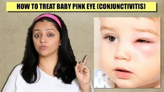 How To Treat Baby Pink Eye (Conjunctivitis) || Care & Treatment (English)