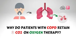 Oxygen Induced CO2 Narcosis in COPD Patients