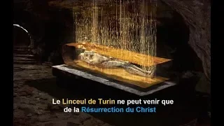 Le Linceul de Turin ne peut venir que de la Résurrection du Christ