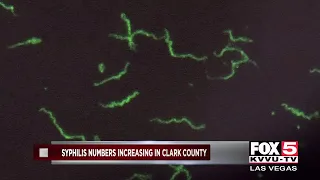 Syphilis numbers increase in Clark County