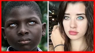 The rarest and most beautiful eyes in the world | Kosmos Tv