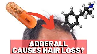 Adderall Hair Loss - What's The TRUTH?