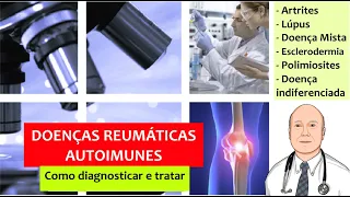 Segredos das doenças reumáticas autoimunes: lúpus, artrites, esclerodermia, doença mista e miosites