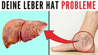 10 Anzeichen dafür,  dass deine Leber echte Problem hat