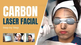Carbon Laser Facial Treatment for glowing skin  | Carbon Laser Facial in Delhi | @SkinQure