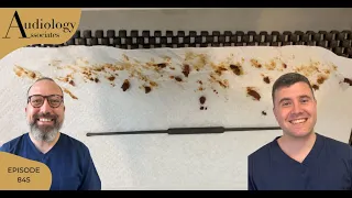 PAINSTAKING EAR WAX REMOVAL WITH JOBSON HORNE - EP845