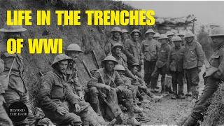 What Was It Like To Be A Trench Soldier | WWI