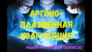 Техника проведения аргоноплазменной коагуляции при язвенных гастродуоденальных кровотечениях.