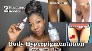 HOW TO LIGHTEN DARK INNER THIGHS & HYPERPIGMENTATION | The only 2 products you need‼️