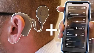 Cochlear Implants and Smartphones are Changing Lives!