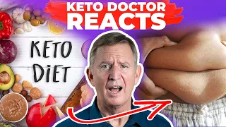 KETOSIS DOESN'T WORK? - Dr. Westman Reacts