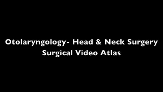 Neck Dissection: Levels I-III