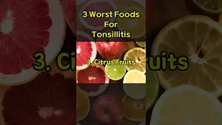 3 Worst Foods For Tonsillitis!
