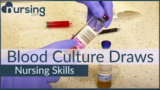 Blood Culture Draws- Top Priorities  (Nursing Skills)