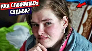 КАК сложилась жизнь Елены, найденной в собачей будке, под Тулой 13 лет назад⁠⁠?