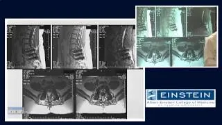 Introducing MRI: Artifacts (46 of 56)