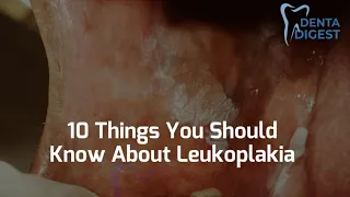 10 Things You Should Know About Leukoplakia and Oral cancer